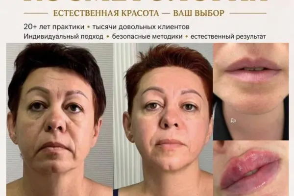Инъекционная косметология