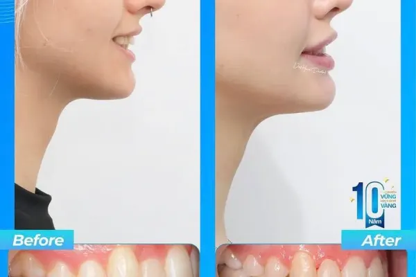 VIET HAN DENTAL