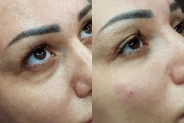 Esthetic Pro Нячанг