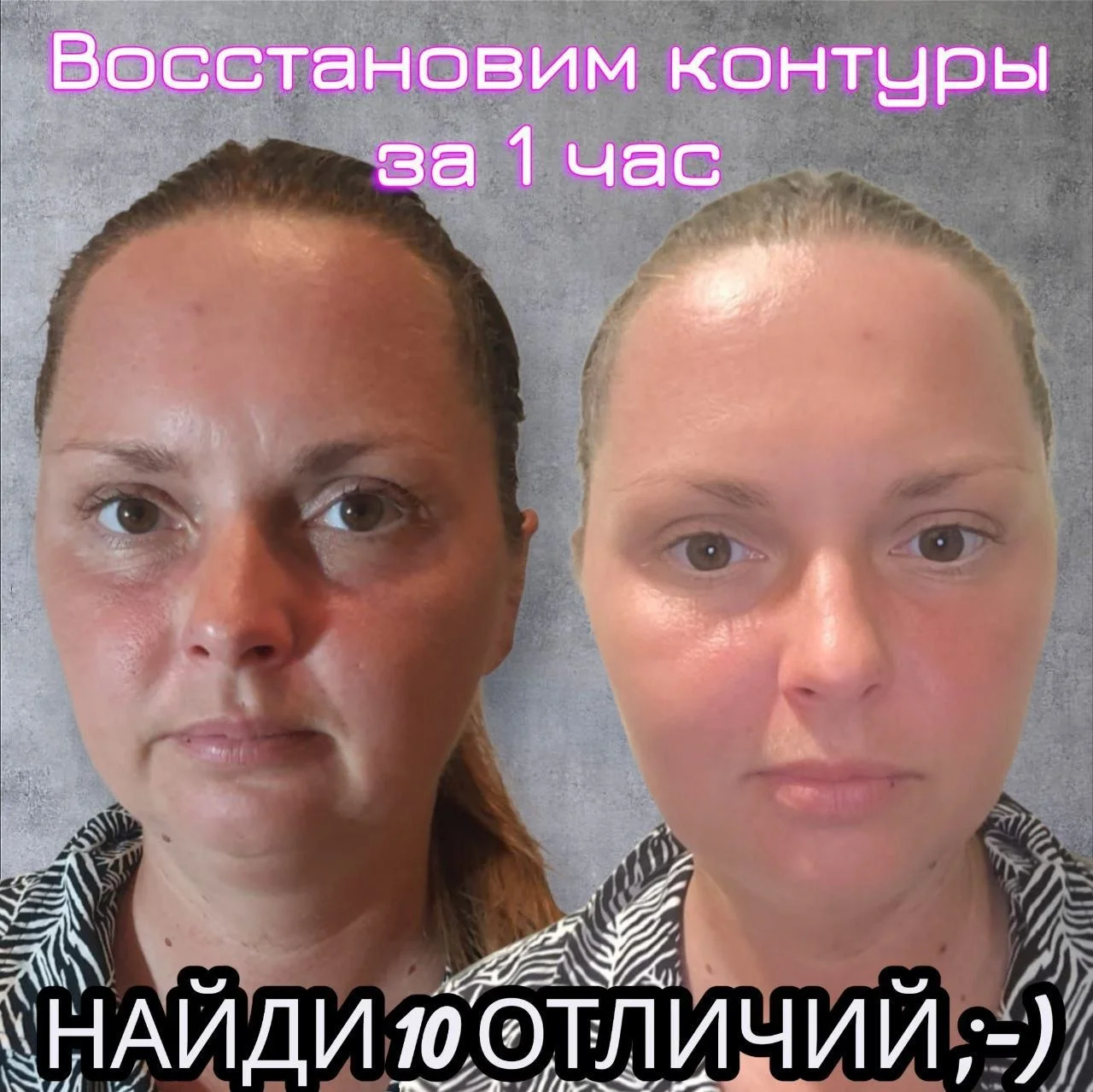 Тайский массаж лица