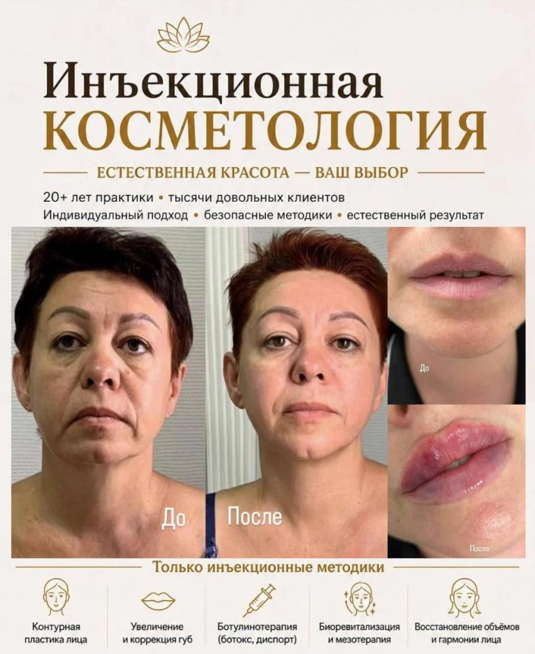 Инъекционная косметология