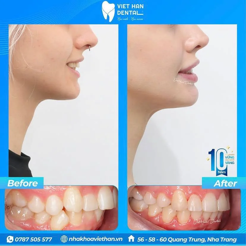VIET HAN DENTAL